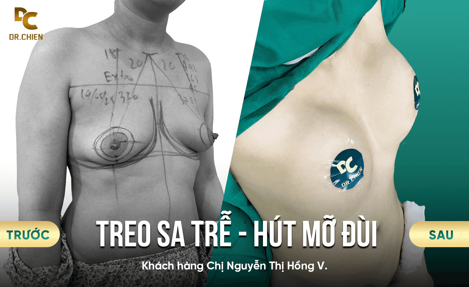 Nguyễn Thị Hồng Vân